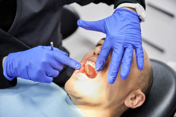 Best Broken or Chipped Tooth Repair in North Druid Hills, GA